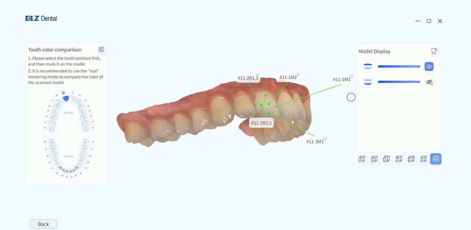 Determinarea culorii: pozițiile dentare marcate cu coduri de culoare pe modelul scanat